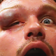 Illustration for article titled Matt Mitriones Eye Is So Gross We Had To Censor It For You